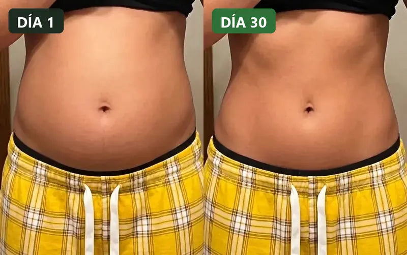 Abdomen el día 1 y el día 30 del protocolo ParaGuard
