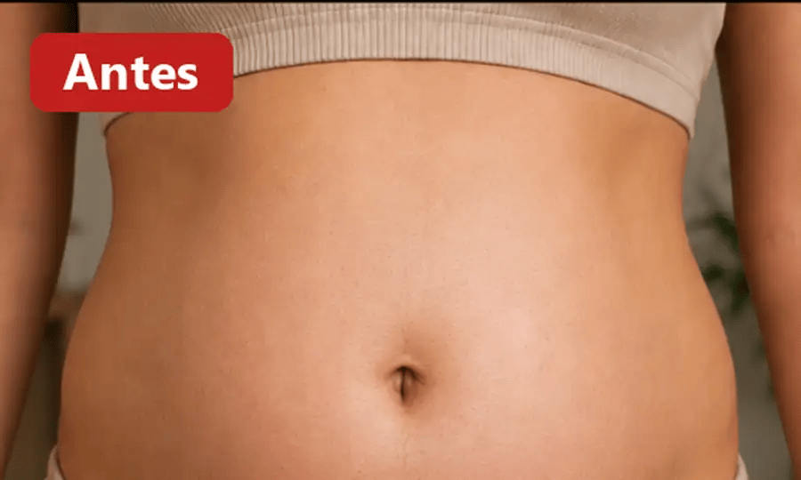 Abdomen antes y después